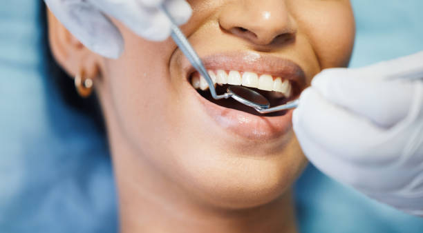 Best Emergency Root Canal Treatment in Parker, FL